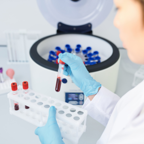 Centrifugazione - PRP come funziona