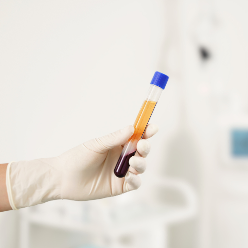 Risospensione Piastrinica - Come funziona il PRP